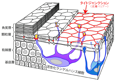 ランゲルハンス細胞図